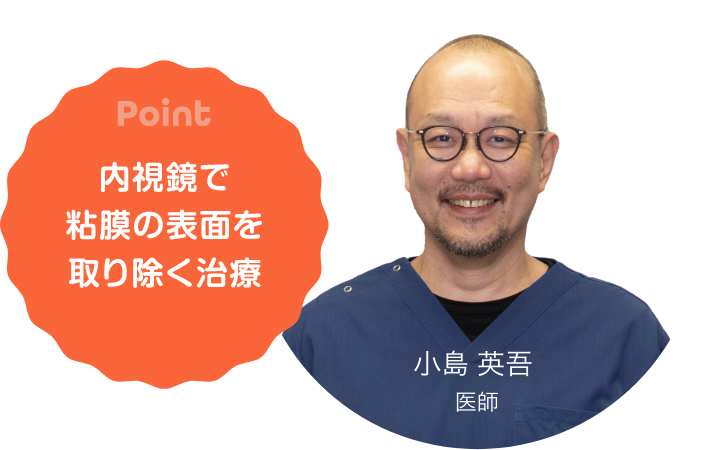 Point 内視鏡で粘膜の表面を取り除く治療