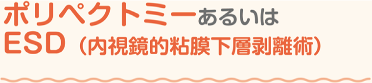 ポリペクトミーあるいはESD（内視鏡的粘膜下層剥離術）