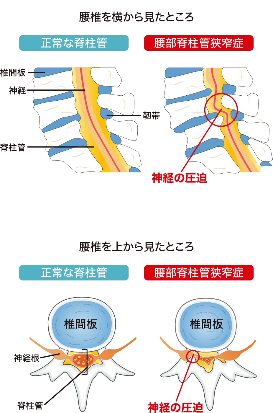 腰椎を横と上からみた図