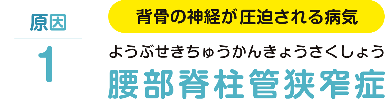 原因１、背骨の神経が圧迫される病気、腰部脊柱管狭窄症