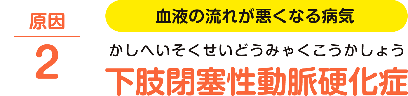 原因２、血流が悪くなる病気「下肢閉塞性動脈硬化症」