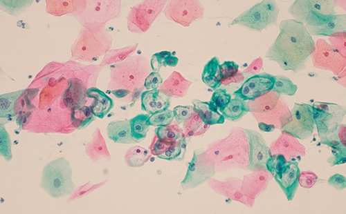 細胞診の顕微鏡写真