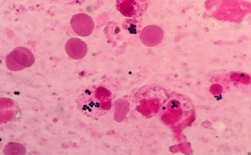 グラム染色の顕微鏡写真